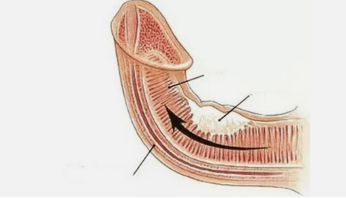 Elimination of venous output